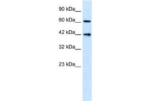 WB Suggested Anti-CFLAR  Antibody Titration: 1. (FLIP Antikörper  (N-Term))