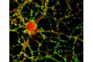 anti-Synaptopodin (SYNPO) (Center) antibody