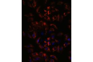 Immunofluorescence analysis of U-2 OS cells using RA antibody (ABIN3015732, ABIN3015733, ABIN3015734, ABIN1682427 and ABIN1682428) at dilution of 1:100. (RAB27A Antikörper  (AA 1-221))