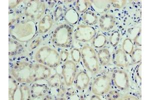 Immunohistochemistry of paraffin-embedded human kidney tissue using ABIN7175278 at dilution of 1:100