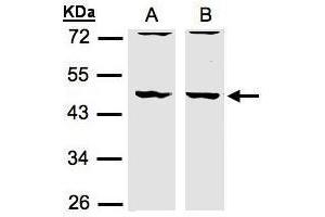 WB Image Sample(30 μg of whole cell lysate) A:HeLa S3, B:MOLT4, 10% SDS PAGE antibody diluted at 1:1500 (DBNL Antikörper  (N-Term))