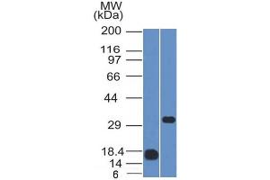 Western Blot Analysis (1) Human CD79b recombinant fragment and (2) Raji cell lysate using CD79b Mouse Monoclonal Antibody (IGB/1843). (CD79b Antikörper  (AA 29-159))