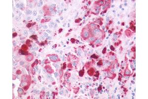 Immunohistochemistry (IHC) image for anti-Pyrimidinergic Receptor P2Y, G-Protein Coupled, 4 (P2RY4) (Extracellular Domain) antibody (ABIN1049219)