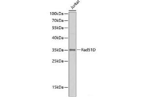 Western blot analysis of extracts of Jurkat cells using Rad51D Polyclonal Antibody at dilution of 1:500. (RAD51D Antikörper)