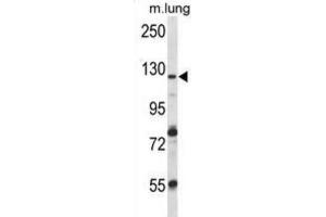 Western Blotting (WB) image for anti-Vacuolar Protein Sorting 54 Homolog (VPS54) antibody (ABIN2997036)