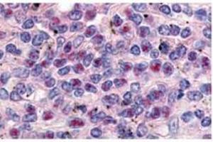 Anti-Cyclin L1a Antibody - Immunohistochemistry  anti-Cyclin L1a antibody was used at a 10 µg/ml to detect Cyclin L1ain a variety of tissues including breast (collagen), heart, kidney (distal tubules), liver, skeletal muscle, ovary (granulosa and oocyte), pancreas (islet), placenta (trophoblast), prostate (epithelium), skin, spleen (endothelium), stomach (chief), testes (seminiferous epithelium and leydig), thymus (Has-sal's corpuscle and lymphocytes) and uterus (glandular epithelium and stroma).