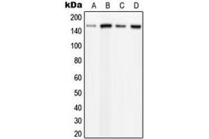 Western blot analysis of PLC beta 3 (pS537) expression in HeLa PMA-treated (A), MCF7 UV-treated (B), mouse brain (C), rat brain (D) whole cell lysates.