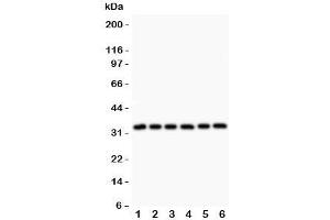Western blot testing of MyD88 antibody and Lane 1:  rat heart;  2: human HeLa;  3: (h) MCF7;  4: (h) HEPG2;  5: (h) Jurkat;  6: (h) Raji.