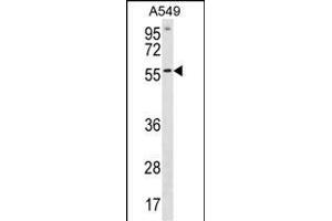 ETV5 Antibody (N-term) (ABIN1881325 and ABIN2838889) western blot analysis in A549 cell line lysates (35 μg/lane).
