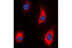 Immunofluorescent analysis of Tensin 3 staining in HeLa cells. (TNS3 Antikörper)