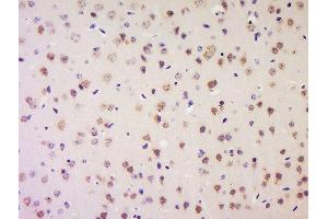 Immunohistochemistry (Paraffin-embedded Sections) (IHC (p)) image for anti-Low Density Lipoprotein Receptor-Related Protein 1 (LRP1) (AA 4451-4545) antibody (ABIN748988)