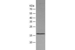 CoREST Protein (AA 305-482) (His tag)