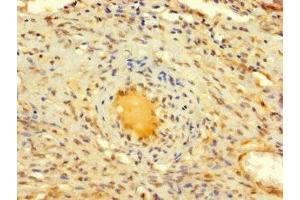 Immunohistochemistry of paraffin-embedded human ovarian tissue using ABIN7150017 at dilution of 1:100 (DIS3L2 Antikörper  (AA 201-400))