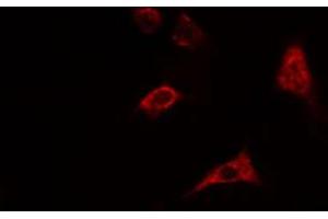ABIN6274550 staining HepG2 cells by IF/ICC. (CHKB Antikörper  (C-Term))