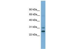 Image no. 1 for anti-Dehydrogenase/reductase (SDR Family) Member 2 (DHRS2) (AA 27-76) antibody (ABIN6745489) (DHRS2 Antikörper  (AA 27-76))