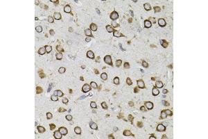 Immunohistochemistry of paraffin-embedded mouse brain using CEP164 antibody. (CEP164 Antikörper)