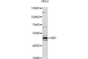 Western blot analysis of extracts of HeLa cells, using MIIP antibody (ABIN6293240) at 1:3000 dilution. (MIIP Antikörper)