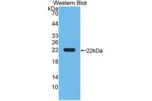 Detection of Recombinant DBP, Rat using Monoclonal Antibody to Vitamin D Binding Protein (DBP) (Vitamin D-Binding Protein Antikörper  (AA 209-394))