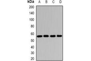 Western blot analysis of SCOT expression in Hela (A), Jurkat (B), mouse heart (C), rat kidney (D) whole cell lysates. (OXCT1 Antikörper)
