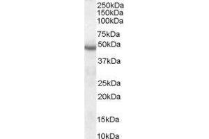 serpin Peptidase Inhibitor, Clade I (neuroserpin), Member 1 (SERPINI1) peptide