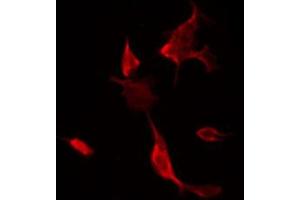 ABIN6266541 staining NIH-3T3 by IF/ICC. (FLI1 Antikörper  (Internal Region))