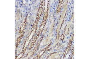 Immunohistochemistry of paraffin-embedded rat spleen using [KO Validated] Heme Oxygenase 1 (HO-1/HMOX1) Rabbit pAb (ABIN6131781, ABIN6141881, ABIN6141883 and ABIN6215065) at dilution of 1:50 (40x lens). (HMOX1 Antikörper  (AA 1-288))