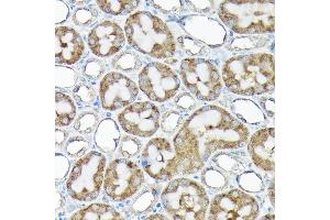 Immunohistochemistry (IHC) image for anti-Ribosomal Protein S15a (RA) (AA 1-130) antibody (ABIN6147201)