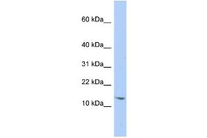 WB Suggested Anti-SNRPD2 Antibody Titration:  0. (SNRPD2 Antikörper  (N-Term))