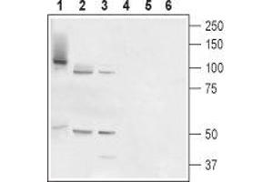 Western blot analysis of rat prostate (lanes 1 and 4), testis (lanes 2 and 5) and placenta (lanes 3 and 6): - 1-3. (TMC6 Antikörper  (Cytosolic, Intracellular))