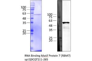 Western Blotting (WB) image for RNA Binding Motif Protein 7 (RBM7) (AA 1-265) protein (Strep Tag) (ABIN3128367) (RBM7 Protein (AA 1-265) (Strep Tag))