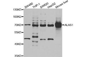 Western blot analysis of extracts of various cell lines, using ALAS1 antibody (ABIN5973906) at 1/1000 dilution. (ALAS1 Antikörper)
