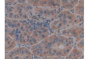 Immunohistochemistry (IHC) image for anti-Thrombospondin 1 (THBS1) (AA 24-221) antibody (ABIN7432184)