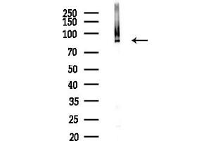 Western blot analysis of lysates from  cells(heat-shock,45 min treatment), using ATP2 Antibody at 1/1000 dilution.