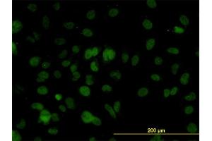 Immunofluorescence of monoclonal antibody to SMARCD2 on HeLa cell.