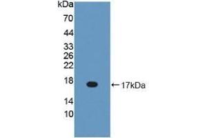 Detection of Recombinant BPI, Mouse using Polyclonal Antibody to Bactericidal/Permeability Increasing Protein (BPI) (BPI Antikörper  (AA 320-457))