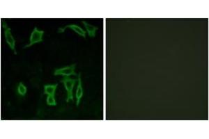 Immunofluorescence analysis of LOVO cells, using GRM5 Antibody. (Metabotropic Glutamate Receptor 5 Antikörper  (AA 21-70))