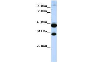 WB Suggested Anti-ZNF138 Antibody Titration:  0. (ZNF138 Antikörper  (C-Term))