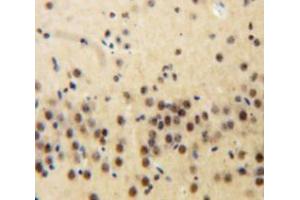 Used in DAB staining on fromalin fixed paraffin-embedded Brain tissue (Plakophilin 2 Antikörper  (AA 571-849))