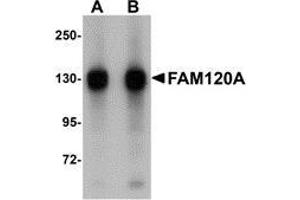 Western blot analysis of FAM120A in SK-N-SH cell lysate with AP30329PU-N FAM120A antibody at (A) 0.