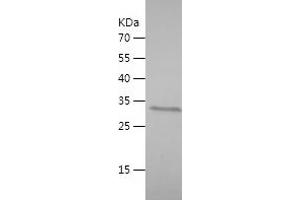 Western Blotting (WB) image for SWI/SNF Related, Matrix Associated, Actin Dependent Regulator of Chromatin, Subfamily A-Like 1 (SMARCAL1) (AA 683-954) protein (His-IF2DI Tag) (ABIN7283891) (SMARCAL1 Protein (AA 683-954) (His-IF2DI Tag))