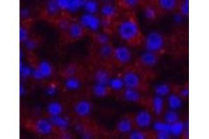 Immunofluorescence analysis of Mouse kidney tissue using AMACR Monoclonal Antibody at dilution of 1:200. (AMACR Antikörper)