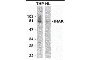 Western Blotting (WB) image for anti-Interleukin-1 Receptor-Associated Kinase 1 (IRAK1) (C-Term) antibody (ABIN2475130) (IRAK1 Antikörper  (C-Term))