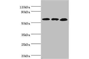 Western blot All lanes: Glutamate dehydrogenase 2, mitochondrial antibody at 4 μg/mL Lane 1: Mouse brain tissue Lane 2: 293T whole cell lysate Lane 3: Rat brain tissue Secondary Goat polyclonal to rabbit IgG at 1/10000 dilution Predicted band size: 61 kDa Observed band size: 61 kDa (GLUD2 Antikörper  (AA 319-558))
