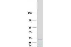 Validation with Western Blot (RPL35 Protein (Myc-DYKDDDDK Tag))