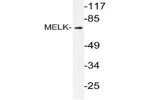 Western blot (WB) analysis of MELK antibody in extracts from k562 cells. (MELK Antikörper)