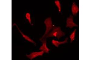 Immunofluorescence (fixed cells) (IF/ICC) image for anti-Potassium Voltage-Gated Channel, Shal-Related Subfamily, Member 1 (Kcnd1) (C-Term) antibody (ABIN6258969)