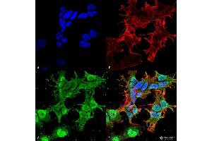 Immunocytochemistry/Immunofluorescence analysis using Mouse Anti-TARP Gamma2/4/8 (Stargazin) Monoclonal Antibody, Clone S245-36 . (Stargazin Antikörper  (AA 203-323) (FITC))