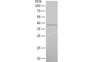 MAP2 Protein (AA 1-226) (His tag)