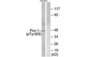 Western blot analysis of extracts from HuvEc cells treated with PMA 125ng/ml 30', using Pim-1 (Phospho-Tyr309) Antibody.