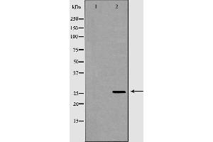 Western blot analysis of Hela whole cell lysates, using GSTM2 Antibody.